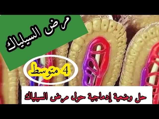وضعية إدماجية حول مرض السيلياك علوم طبيعية رابعة متوسط