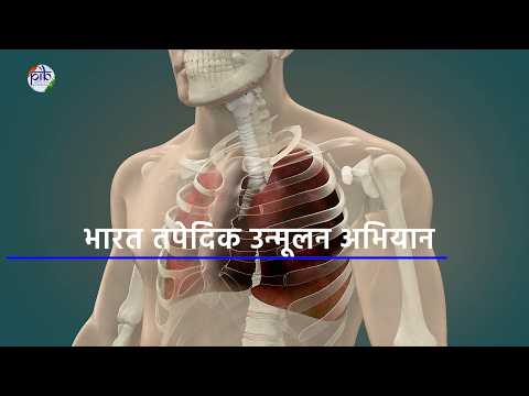 भारत टीबी उन्मूलन की दिशा में तेजी से अग्रसर