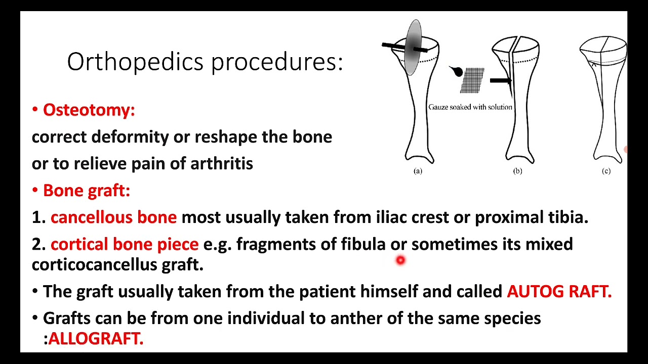 Orthopedics introduction: Definitions and healing process.