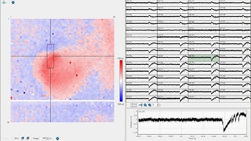 Hippocampus slice on CMOS MEA