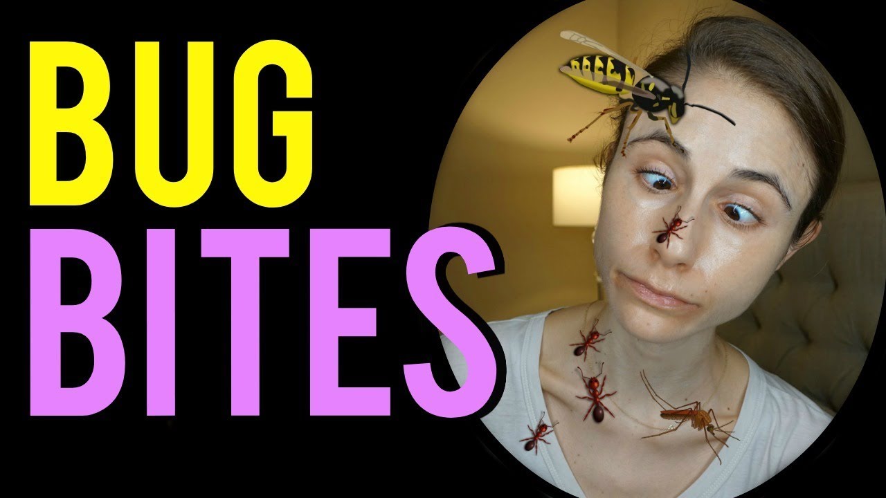 dr dray niacinamide Tips for bug bites & stings| Dr Dray