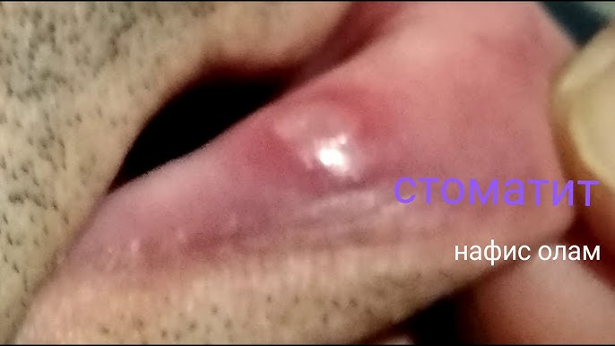 Porno yosh gozal Uyda yashirin kamerali porno videolarni tomosha qiling