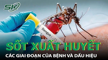 Giai Đoạn Nguy Hiểm Nhất Của Bệnh Sốt Xuất Huyết Tránh Nhầm Lẫn I SKĐS