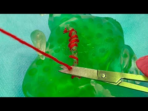 حدثت حادثة ضفدع أخضر