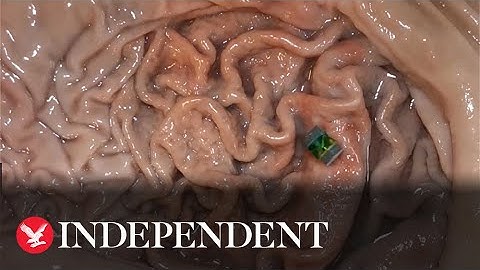 Scientists create tiny robot that travels through body to cure diseases