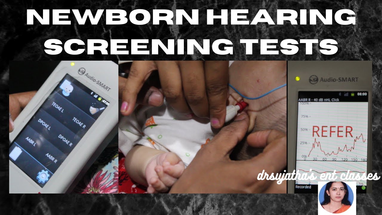 081.Newborn Hearing Screening Tests  #OAE  #BERA  #ABER #hearingimpaired #hearingloss #detection