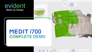 Medit i700 Demo From Evident screenshot 5