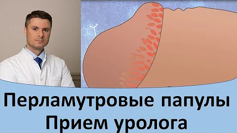 Перламутровые папулы.  Прием уролога