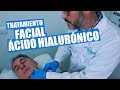 Tratamiento facial con cido hialurnico dr leo cerrud