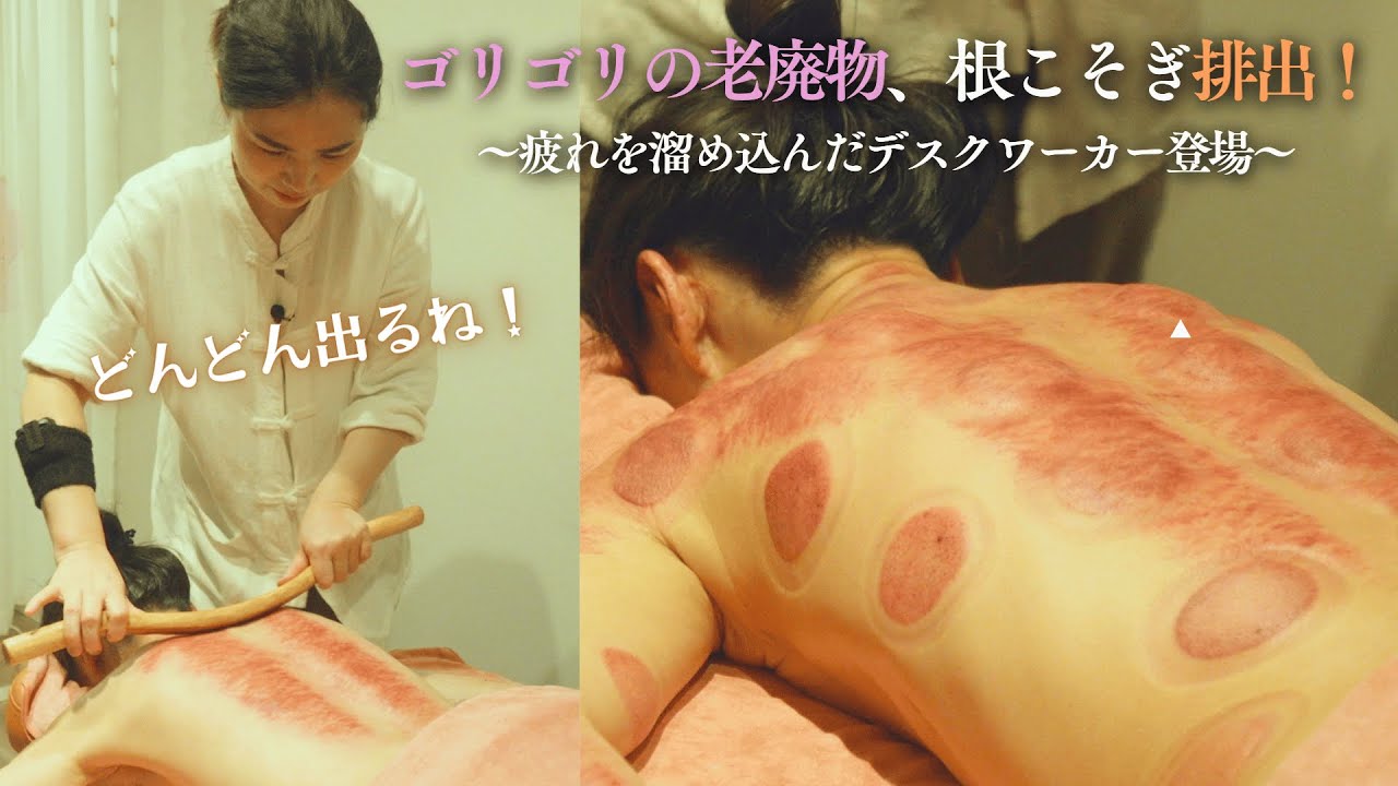 疲労の詰まり、根こそぎ流す。超絶お疲れデスクワーカー向けカッピング＆コリ撃退ケア｜東洋漢方ヘッドスパ＆小顔コルギ KOUHUA【横浜　関内駅2分 コウファ】