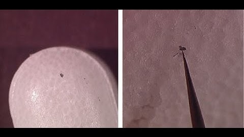 Identifying Foreign Particulate in Pharmaceutical Products