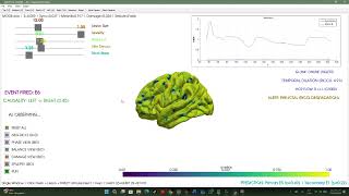 SCDS Motor: Prediction of epileptic seizures through topological collapse (Neuralpress Edition)