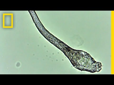 Are Mites Having Sex on Your Face? | National Geographic