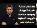 مضاعفات عملية المياه البيضاء وهل تعود المياه البيضاء بعد العملية د أحمد اسامة
