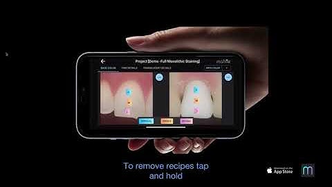 Matisse iOS app - Staining Studio