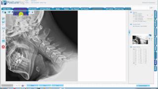 Importing digital x rays screenshot 5