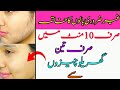 Gher Zarori Balon ka Jar Sr khatam krny k liye AK Cheez Lagao / Awwal e zareen