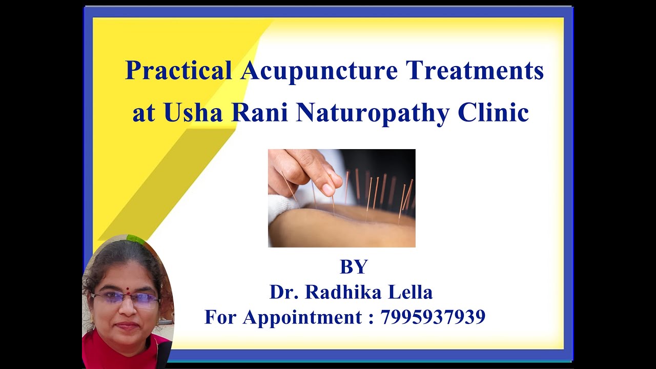 Live Acupuncture treatments at usha rani naturopathy clinic by radhika ...