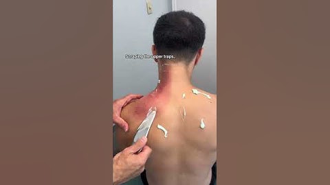Scraping the upper traps #chiropractor #stretch #physiotherapy #fitness #backpain #workout