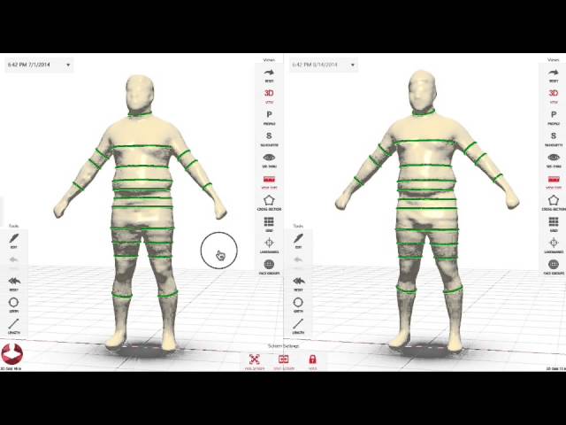 Styku vs. Evolt 360: A 3D Body Scanner Comparison