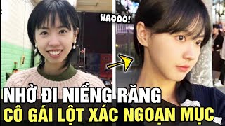 Cô gái xấu xí LỘT XÁC ngoạn mục nhờ NIỀNG RĂNG khiến ai nấy KHÔNG TIN VÀO MẮT MÌNH | TB TREND