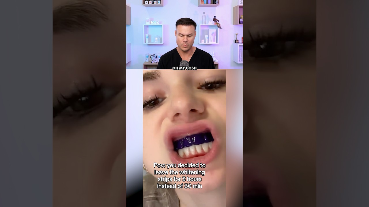 POV You Left Whitening Strips On For 3 HOURS! 😳🦷