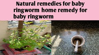 Natural remedies for baby ringworm home remedy for baby ringworm