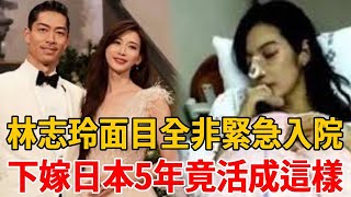 Lin Chi-ling's face was completely unrecognizable, and she was rushed to the hospital! Five years...