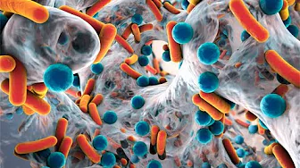 Management of Biofilm and Infection (Webinar)