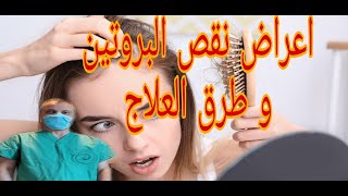 علامات نقص البروتين و العلاج