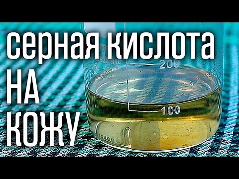 🔥 Что будет если серная кислота попадет на кожу? Первая помощь при ожогах.