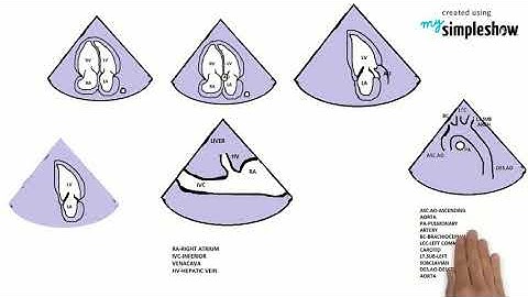 HEART&TECHY -ECHOCARDIOGRAM BASIC VIEWS-Transthoracic echocardiogram