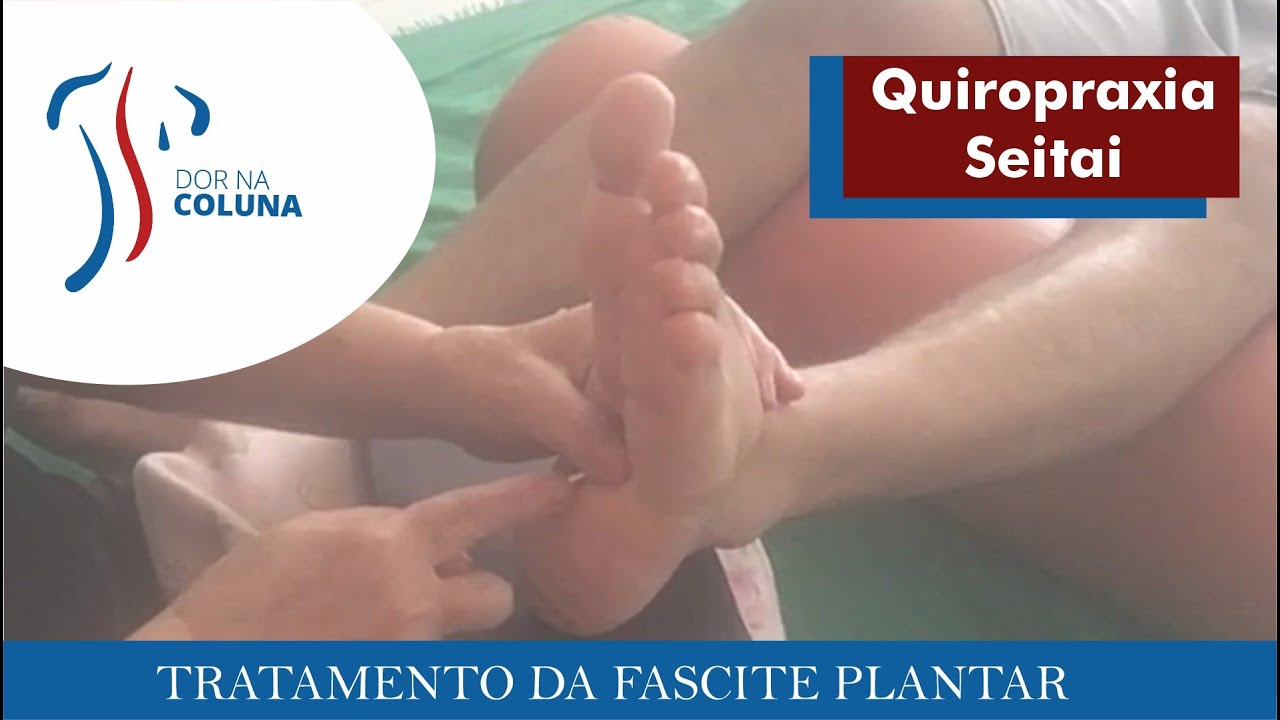 Tratamento FASCITE PLANTAR com Quiropraxia e Seitai