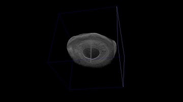 Casia Anterior Chamber OCT 3D View