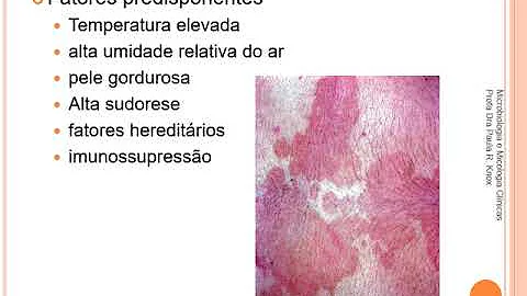 Quais são as micoses cutâneas?