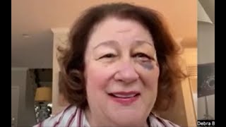 Margo Martindale: 'Nothing makes me happier than desperate people being funny' | GOLD DERBY