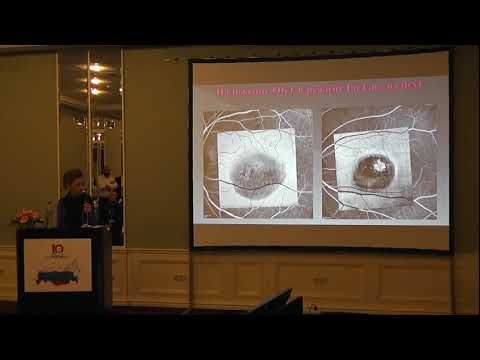 Видео: Флюоресцентная ангиография: цель, методика и результаты