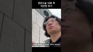 정관수술 직후 후기