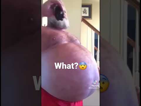 Big belly man #shorts #shortsvideo #shocking