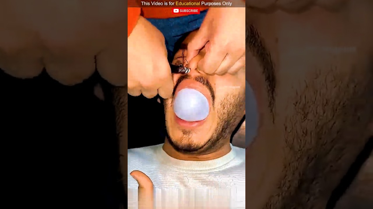 A Balloon Coming Out of the Mouth? 😨||@The_mabhus #shorts