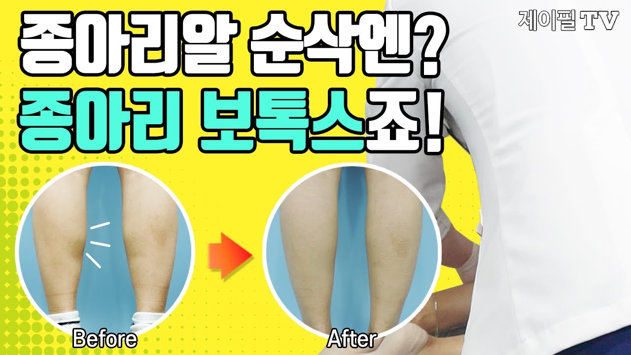 종아리알빼는법? 확실한 종아리보톡스