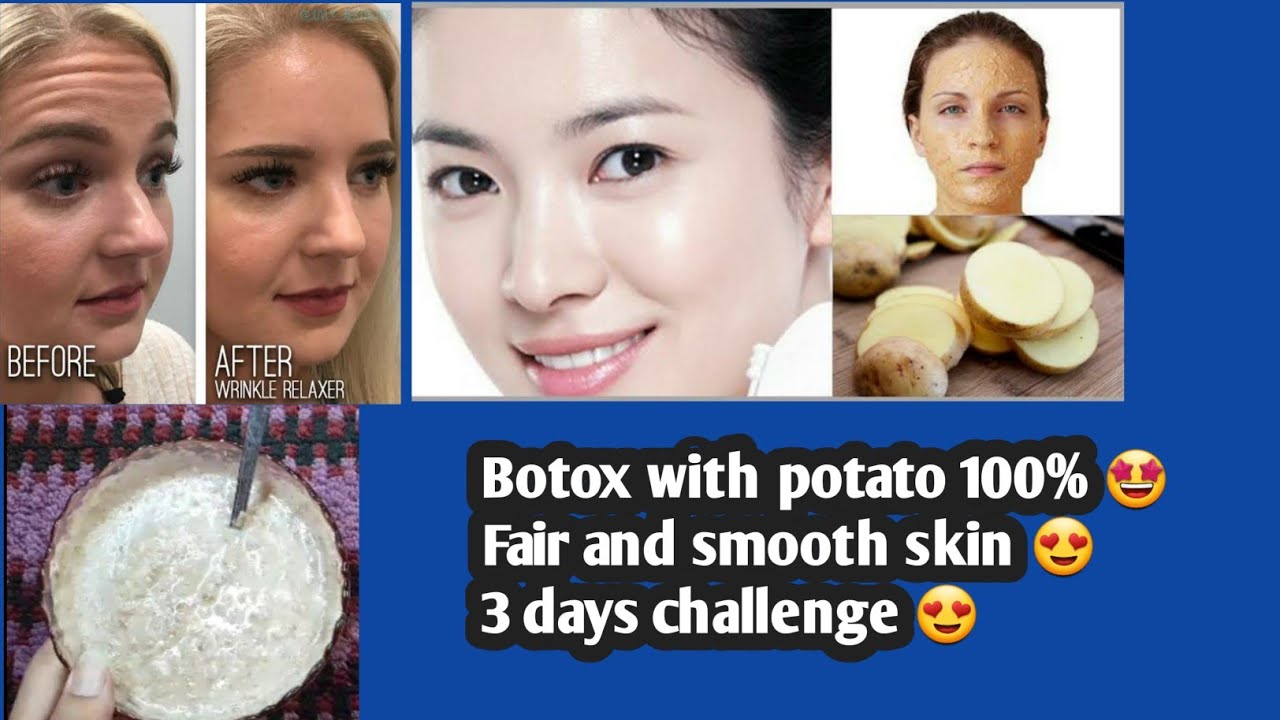 NATURAL SKIN BOTOX TREATMENTAnti AgingFair and smooth skin3 days challenge100Works