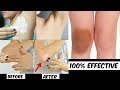 How To Lighten Dark Knees, Dark Elbows, Dark Underarms - Lighten Your Dark Body Parts Naturally