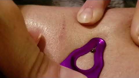 Simple Tick Removal with Original Tick Key™