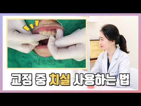 치아 교정 중 치실 하는 방법 [강동구 치과, 강동구 교정치과] dental flossing during orthodontic treatment