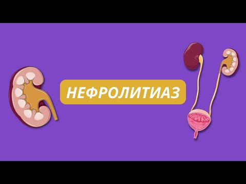 Нефролитиаз (Почечнокаменная болезнь), виды камней, физиология образования, лечение