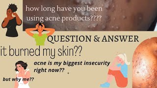 ACNE PRODUCTS QUESTION AND ANSWER ..IT BURNED MY SKIN,..WHY PRODUCTS CAN I USE