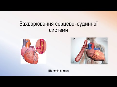 Біологія 8 клас. Захворювання серцево-судинної системи