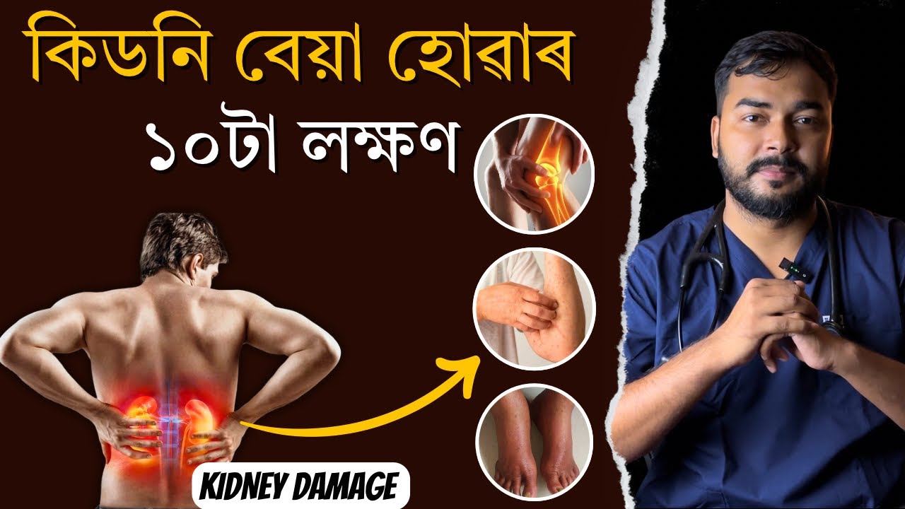 কিডনি বেয়া হোৱাৰ ১০টা লক্ষণ | Warning Sign & Symptoms of Kidney Disease | Dr. Hriday J Deka