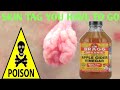 How To Remove A Skin Tag Using Apple Cider Vinegar